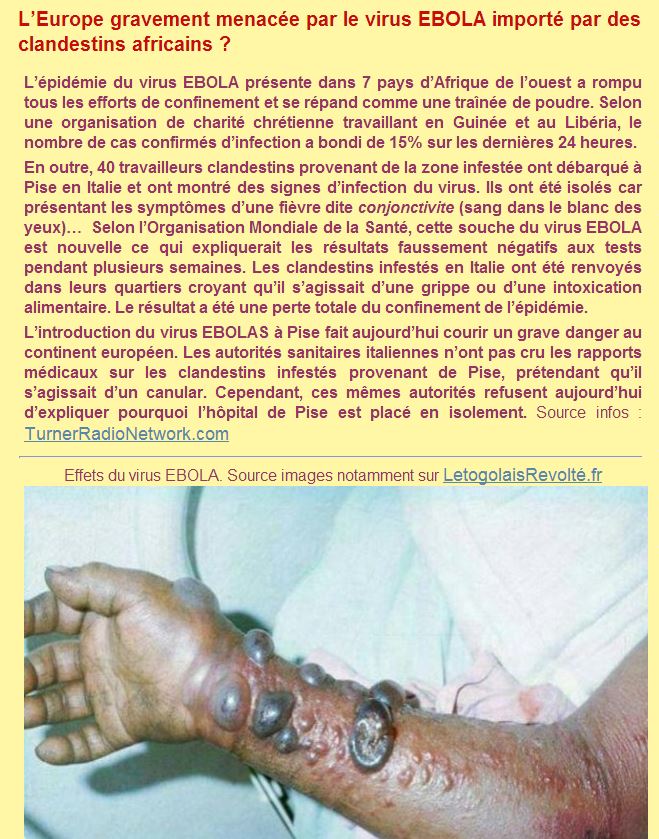ebola-francia