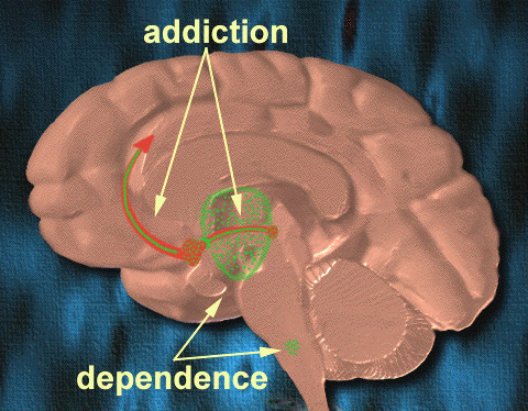 Addictiondependence1