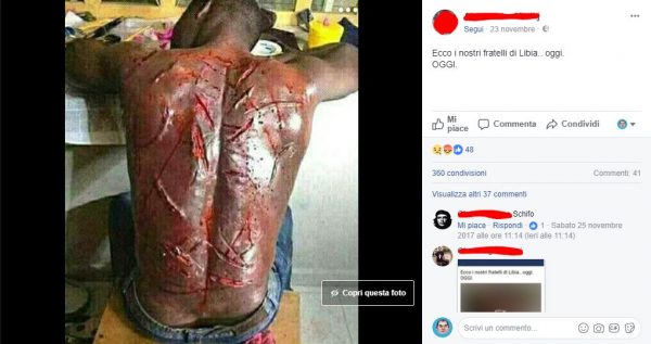 Foto che mostra la schiena di un uomo di colore con segni di tagli/frustate